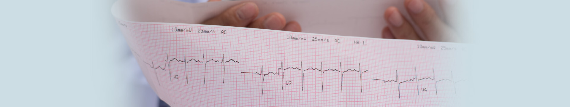 Elektrokonverzija srčanog ritma